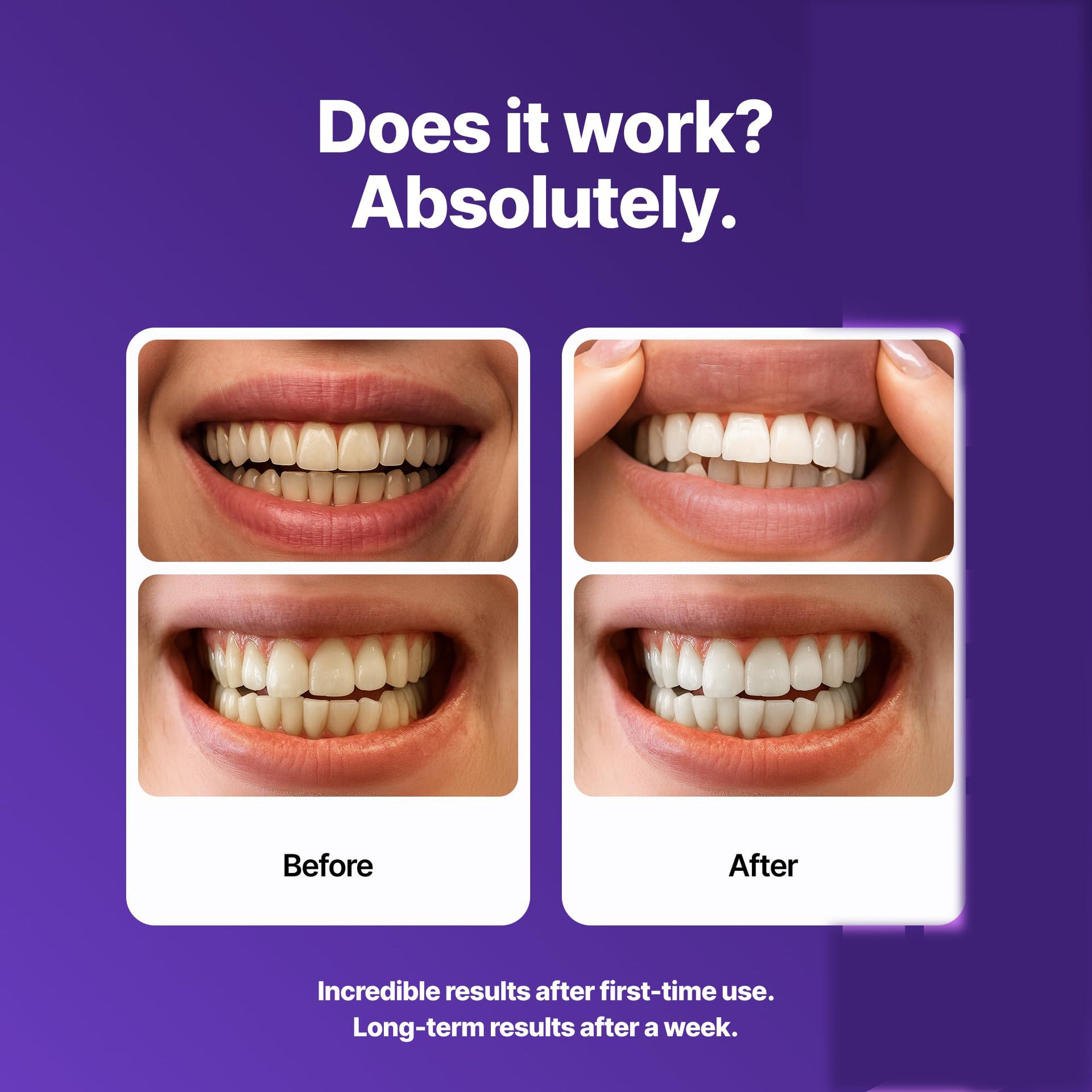 Dr Dent purple teeth whitening strips